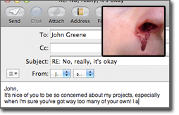 Pictured: the email that led to the injuries (bloody nose, inset)